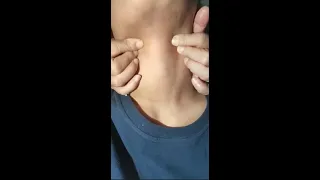 indonesian woman neck strangle strangle neckchallenge cekik