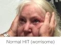 The HINTS exam