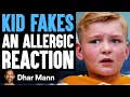 Kid FAKES ALLERGIC REACTION He Instantly Regrets It Dhar Mann