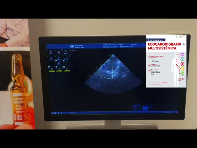 Doppler transcraneal en cardiologia