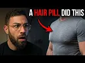 I Got Man Boobs From Dutasteride Here s Your Real Risk on Finasteride Too