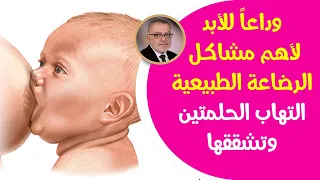 طرق تسيطرعلى أهم مشاكل الرضاعة ماذايعني التهاب حلمة الثدي وماهو الحل الأفضل لتشقق وحكة الحلمتين 
