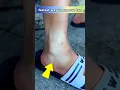 Download Lagu Fastest Way To Remove Suntan At Home#shorts#skincare#suntanremoval#