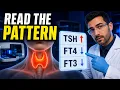 Thyroid Function Tests Explained TSH FT4 FT3