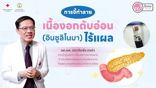  วิธีการวินิจฉัยโรคเนื้องอกตับอ่อนที่ผลิตอินซูลินมากเกินไปทำอย่างไร 