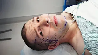 They Cut Open My Face… Here’s What Happened