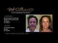 Guilford and Mystic CT Plastic Surgeon Dr Beth Collins Shares Some of Her Best Results