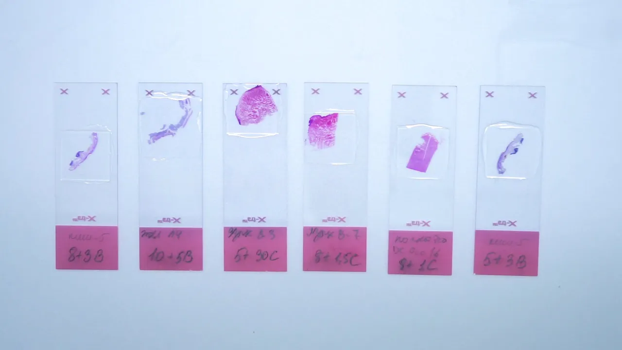Histological staining: hematoxylin & eosin