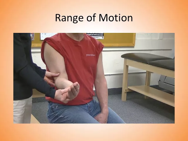 Radial Head Fracture