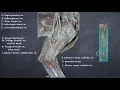 Canine Thoracic Limb Muscles Nerves Vessels Review