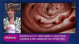 DIVERTICULITE: O que é, quais os sintomas e quando procurar um médico? - Mulheres (08/09/2026)