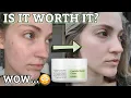 COSRX Centella Blemish Cream Review Testing The COSRX Blemish Cream For 10 Days