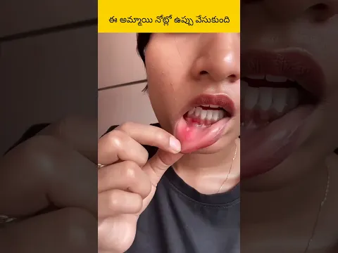 e ammai notlo uppu veysukundhi?