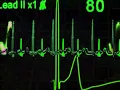 Download Lagu H33RA x CVIRO \u0026 GXNXVS - Cardiac [Visualiser]