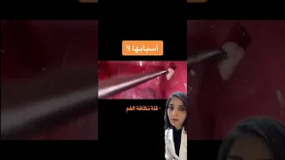 حصى اللوزتين تنظيف الاسنان طبيبة اسنان Medical Dentist Explore ابتسامةهوليود اسنان Doctor 