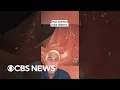 Lagu CBS News’ Dr. Jon LaPook demonstrates how colonoscopies can save your life #shorts