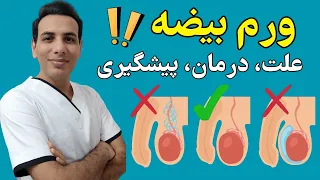 علت ورم بیضه چیست  ۷ درمان ورم بیضه موثر دندنها