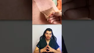 حرق الشمس حروق حروق الليزر حروق البشرة تقشير البشرة تقشير الجسم د مصعب حسوا ثقف نفسك طبيا 