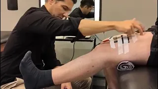 Dor no Joelho para Esticar a Perna - Veja o Tratamento AO VIVO de Fisioterapia 