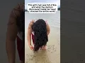 Download Lagu This girl's hair full of lice and what doctors discovered inside shocked the world #viralvideo #yt