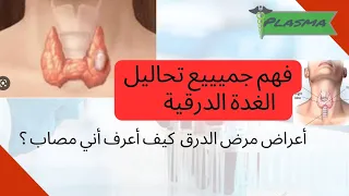شرح تحاليل الغدة الدرقية اعراض خمول الدرق اعراض نشاط الدرق الغدة الدرقية 