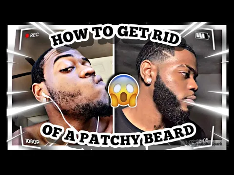 Download MP3 HOW TO FIX A PATCHY BEARD | PATCHY BEARD SOLUTION