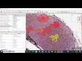 QuPath Annotations
