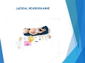 LAERDAL NEWBORN ANNE