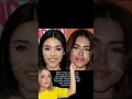 Madison Beer and Her Plastic Surgeries