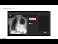 Download Lagu Multimodal Healthcare AI: Identifying and Designing Clinically Relevant Vision-Language Applicati...