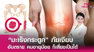 โรคมะเร็งกระดูกคืออะไร และมีกี่ชนิด