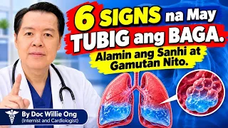 6 Signs na May Tubig ang Baga. - By Doc Willie Ong (Internist and Cardiologist)