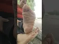 Meaty and Wrinkled #feet #pies #soles