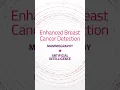Download Lagu Say YES to EBCD! #breastcancerdetection