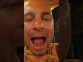 20 permanent gold teeth