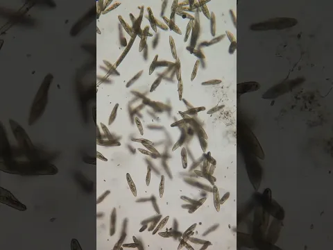 RAIN UNDER A MICROSCOPE
