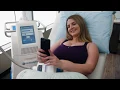 CoolSculpting Day at Ideal Image