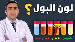 لون البول يدل على حالتك الصحية احذر من اعراض حصى الكلي والتهاب الكبد 