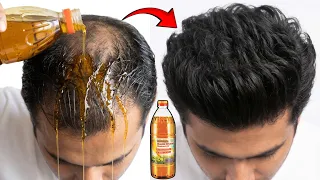 सरसों तेल में यह मिलाकर लगाया 90 दिनों में बाल इतने लंबे मोटे और घने हो गए, Baal Badhane Ke Upay