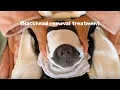 My dog booked a luxury blackhead removal treatment