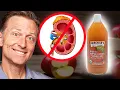 Use Apple Cider Vinegar to Dissolve Kidney Stones