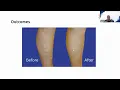 Stop Hiding Your Legs Look and feel confident this summer