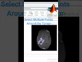 Download Lagu Extract Tumor by Image Segmentation MATLAB- DICOM image