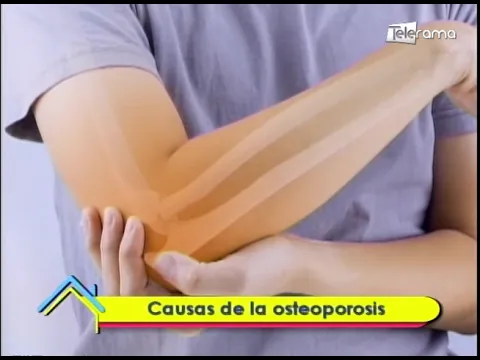 Causas de la osteoporósis