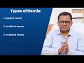 Hiatus Hernia (हाइटस हर्निया) क्या है? | Hiatus Hernia के कारण, लक्षण और उपचार? | Dr. Piyush Ranjan