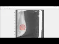 Breast Cancer Detection in Mammogram Images using Deep Learning