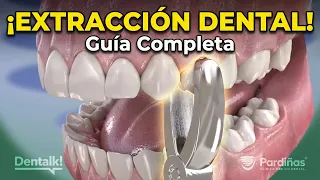 Extracción de diente: Lo que pasa antes, durante y después