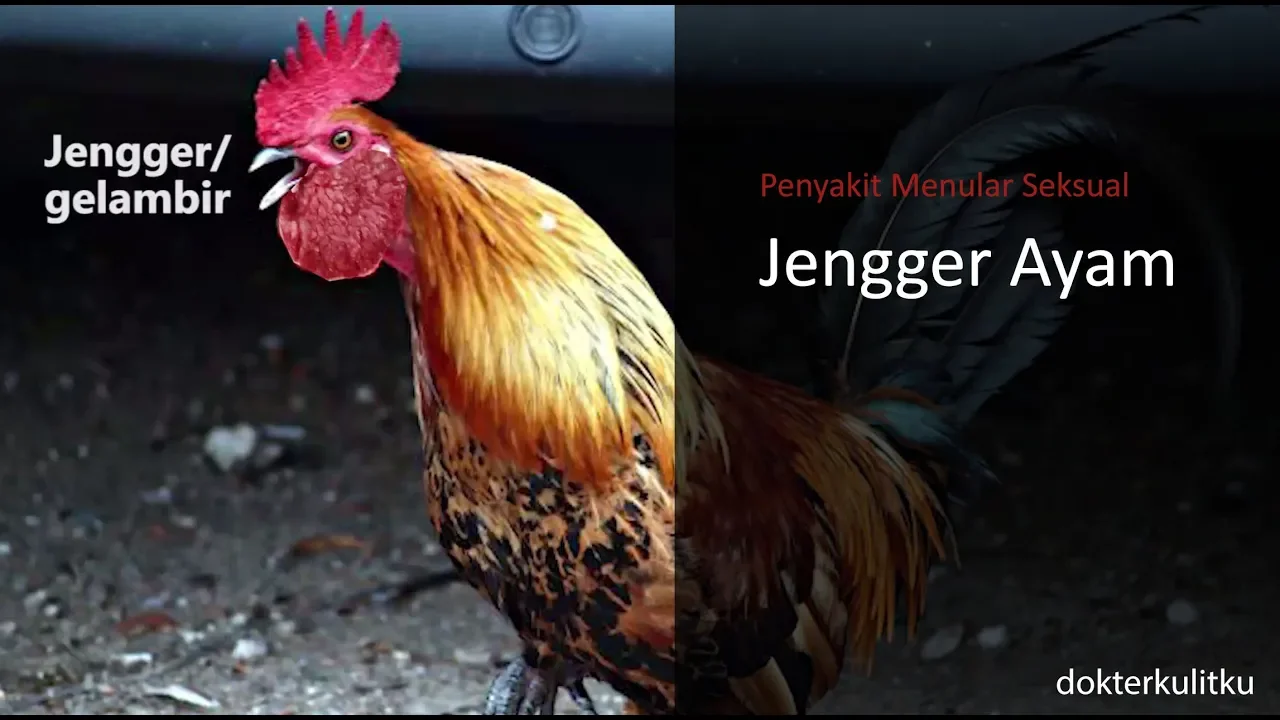 OBAT KUTIL KELAMIN - Cara Mengobati Penyakit Jengger Ayam Secara Alami