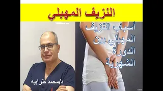 أسباب النزيف المهبلي في غير أوقات الدورة الشهرية   دكتور محمد طرابيه دندنها