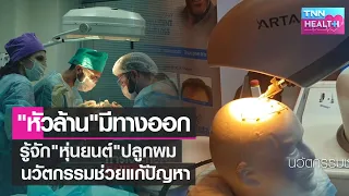  หุ่นยนต์ช่วยในการปลูกผมได้อย่างไรบ้าง 